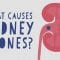 What causes kidney stones? – Arash Shadman