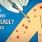 How we conquered the deadly smallpox virus – Simona Zompi