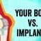 Your body vs. implants – Kaitlyn Sadtler