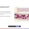 Hypertension High Blood Pressure by Dr Samada